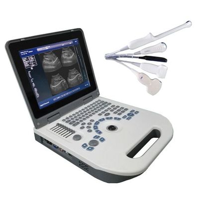 品質  TGC Control Notebook Ultrasound Scanner For Pregnancy Home Use 工場