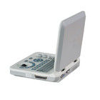 15 インチ LED カラー ポータブル超音波機 60 度スキャン 角度と ≥ 250mm 深度ディスプレイ