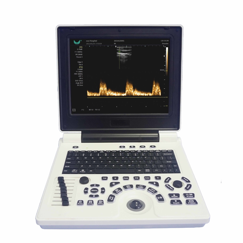 OB GYN妊娠の携帯用色のドップラー超音波機械