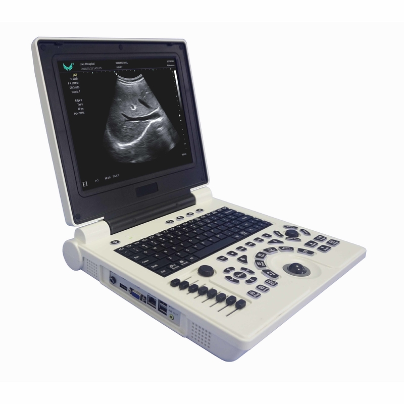 OB GYN妊娠の携帯用色のドップラー超音波機械