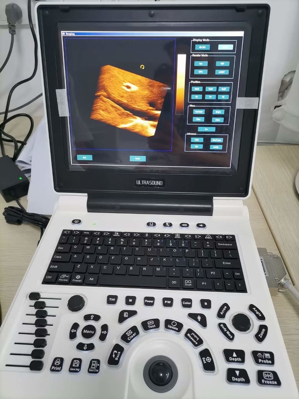 Xianfengの妊娠色のドップラー超音波はイメージ4B OEMを機械で造る