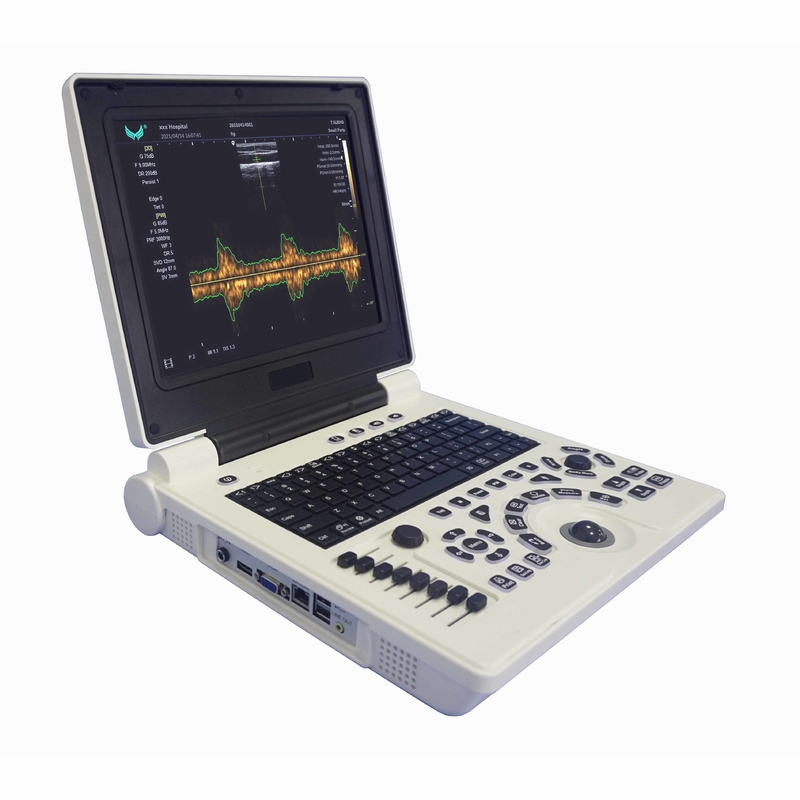 Xianfengの妊娠色のドップラー超音波はイメージ4B OEMを機械で造る