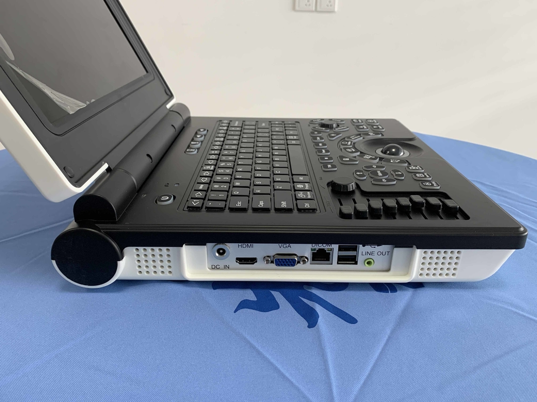 Win7システム携帯用色のドップラー超音波の走査器3200mAh電池