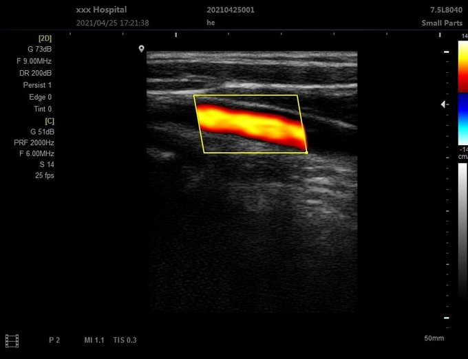 OEMの臨床もてなしの手厚い5のための携帯用3D獣医の超音波機械