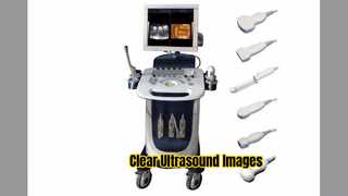 ドップラー超音波スキャナー PW CFM PDI モード