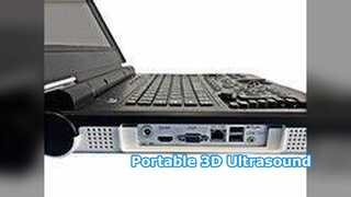 ポータブル超音波 E20 臨床病院