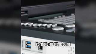 ポータブル 4D ドップラー超音波検査装置 ICU 対応