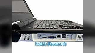 ポータブル カラー ドップラー超音波 E0 泌尿器科スキャン